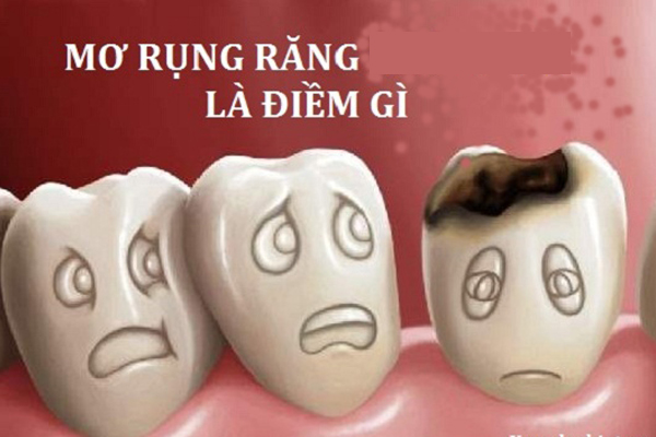 Nằm mơ thấy gãy răng có ý nghĩa gì?